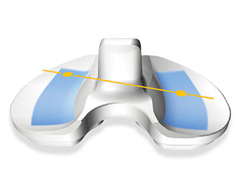 Triathlon | Stryker
